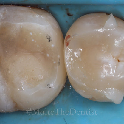 Comprehensive Composite - 2 dages hands on kursus