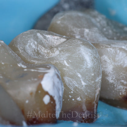 Comprehensive Composite - 2 dages hands on kursus